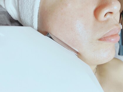 ホーリー(Holly)の写真