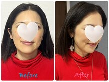 キラリナ/40代☆トータル診断