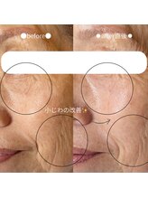 ボン セジュール(Bon sejour)/レチノールララピール