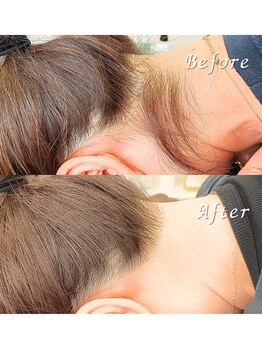 ララリア(LaLaLia)/うなじWAX脱毛