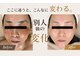 スリミア(Slimia)の写真/【毛穴・シミ・たるみ改善】肌質改善ピーリングで透明感あふれる美肌へ♪