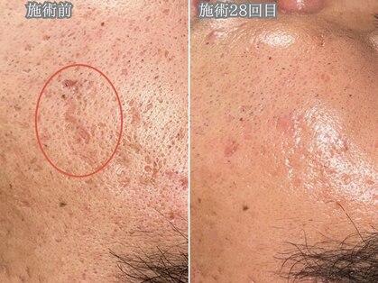 レイル(REIR)の写真