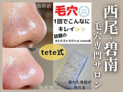 ラティエル(Latiele)の写真