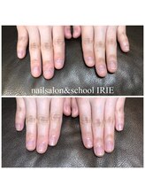 アイリー(IRIE)/自爪育成ケア１回体験