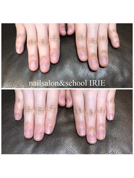 自爪育成ケア１回体験