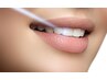 【魅力的な白い歯へ】歯のセルフホワイトニング(16分×2回 )5,500円→5,000円