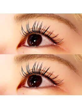 ロイ(ROI)/自然なパッチリ感