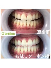 ルブラン 奈良店(Le Blanc)/一生モノのパートナー！！