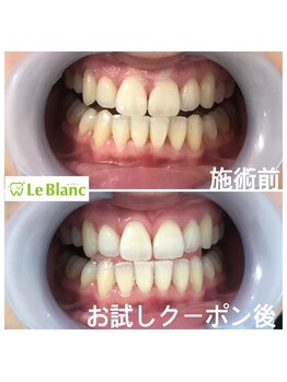 ルブラン 奈良店(Le Blanc)/一生モノのパートナー!!