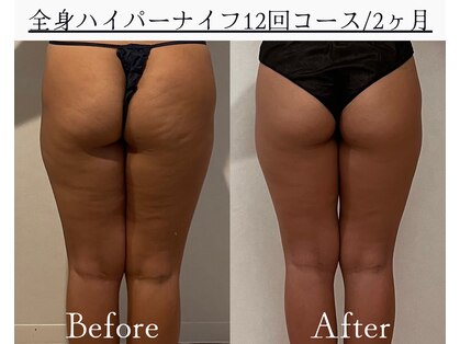 ソアリー バイ サイバーエステ(Soary×CyberEsthe)の写真