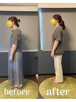 灯(akari)/猫背改善!お客様変化☆20代女性