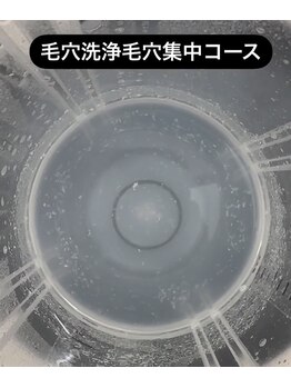 クレン(CLEN)/1番人気【毛穴集中コース】