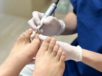 巻き爪/陥入爪/副爪/深爪を解消!