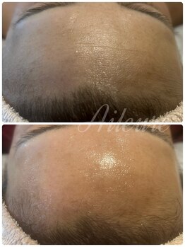 エルール トータルビューティ(Aileure total beauty)/ララピール×Wax