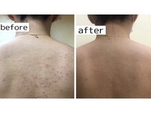 スリリアン 銀座/★お客さまビフォーアフター★