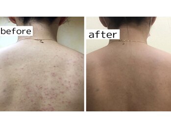 スリリアン 銀座/★お客さまビフォーアフター★