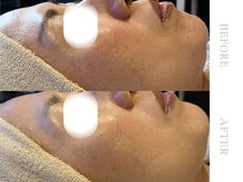 ソワ 恵比寿(soi)/ENVIRONエンビロンフルコース