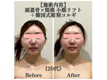 マルウル(maluulu)の雰囲気（鏡を見て思わず驚く変化！余白カット＆中顔面短縮で垢抜け小顔に）