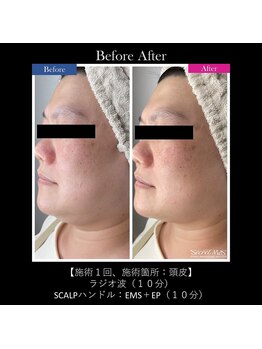 アディクト(Addict)/Before＆After