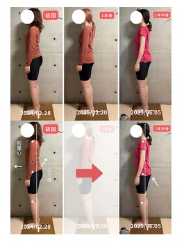 のむら/全身の歪み改善には美容整体