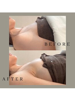 リヴィリア(Revilia)/