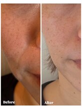 アールヨンマルハチ フェイスアンドアイ(R408.face&eye)/一回の施術！これからが楽しみ