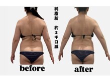 シャルム(CHARME)/深部から温め