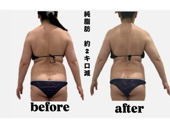 シャルム(CHARME)/深部から温め