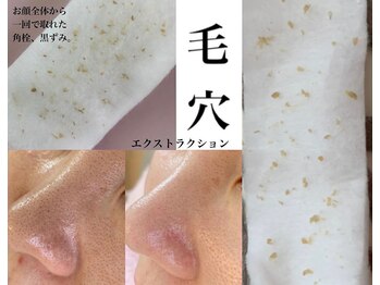 ケフィ(Kefi)の写真/毛穴洗浄エクストラクションで毛穴レスが持続◎結果にこだわるエステ☆憧れのツヤ肌へ
！黒ずみ/ニキビ