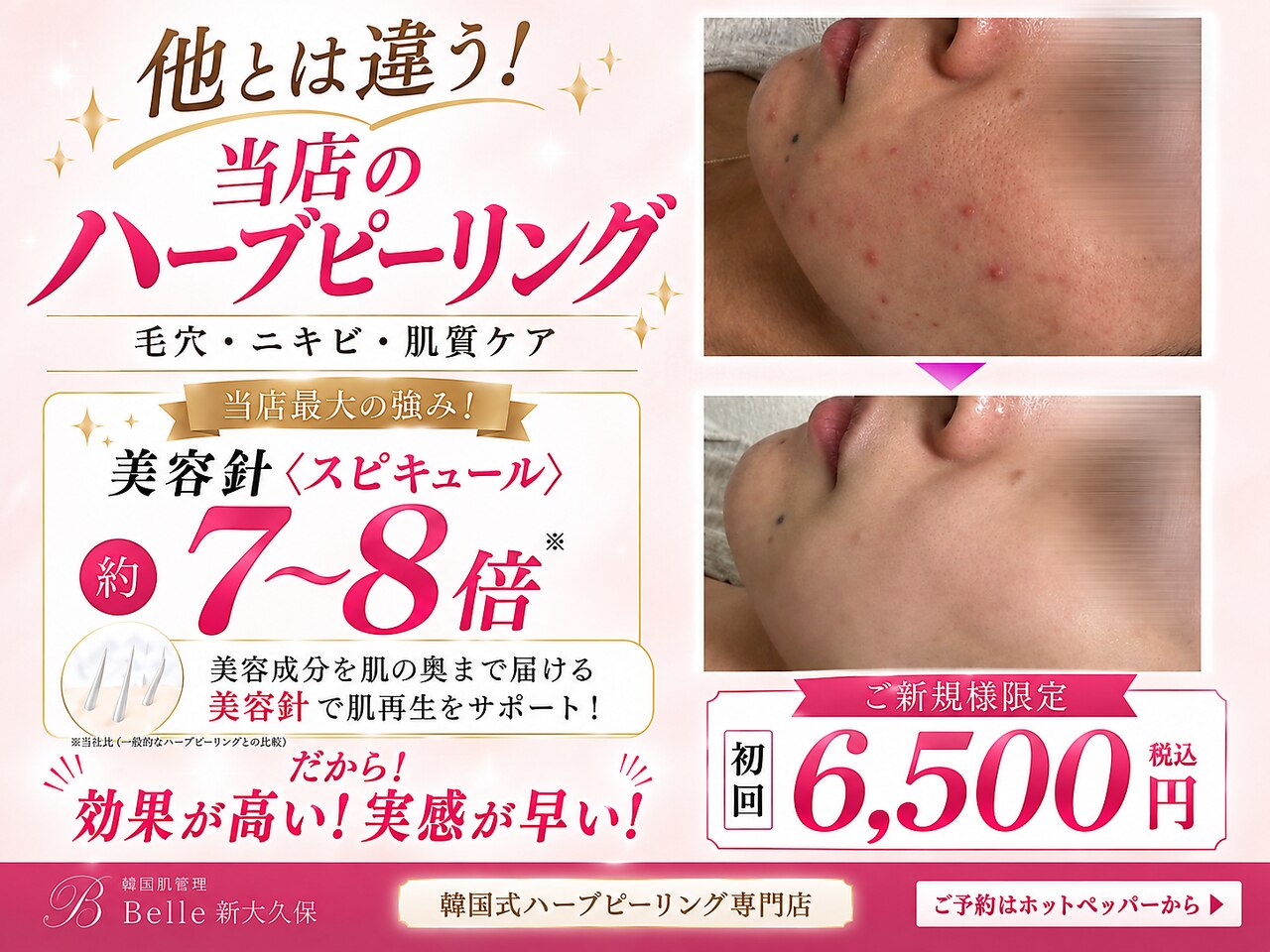 ベル 新大久保(Belle)｜ホットペッパービューティー