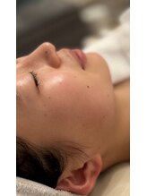 マリーゴールド(marigold)/◇marigoldフェイシャル