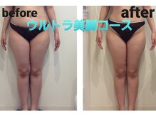 ミエル(Miel)/Before After