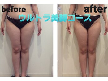 ミエル(Miel)/Before After
