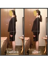 シナジェ 岡山店(Synergye)/小顔・骨盤・猫背・巻肩まで☆