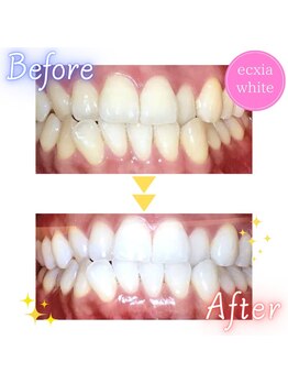 エクシアホワイト SOKA(ecxia white)/