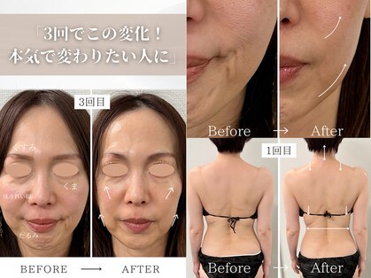 ビューイング(美ing)の写真