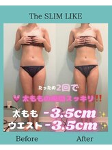 スリムライク 鳥取店(The SLIM LIKE)/痩身ビフォーアフター
