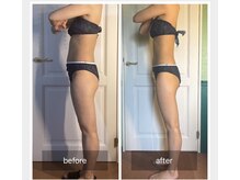 きれい 渋谷恵比寿店/Before/After 