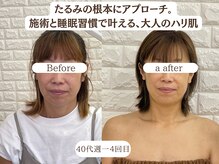 エステサロン クレイドルフェザー