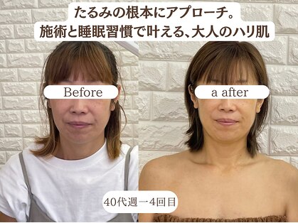 エステサロン クレイドルフェザーの写真