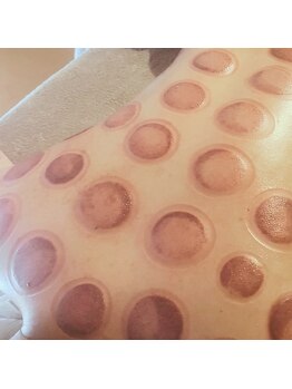 プルトア/かっさよりも深くアプローチ♪