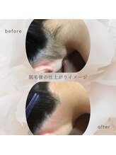 ネロリ(Neroli)/うなじWAX脱毛