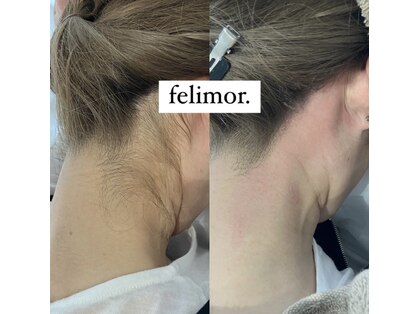 フェリモール(Felimor.)の写真