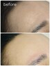マリムーブフェイシャルワック＆眉毛WAX（保湿パック付き）