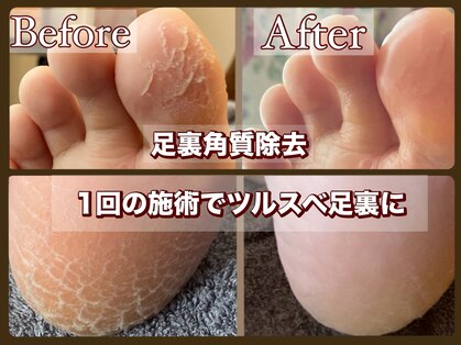ビューティースパ(Beauty-Spa)の写真