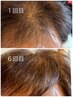 【育毛を促進モニター募集開始】先着限定価格で5名様のみ♪