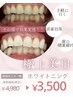 【圧倒的効果♪】お試しホワイトニング今だけ40分照射 通常¥4,980→