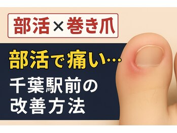 巻き爪じゅん 千葉駅前店/部活による巻き爪の痛み