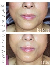 シストワ(sistoi)/自然エイジングケアが一番です♪