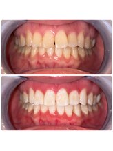 コナホワイトニング 神保町/セルフホワイトニング神保町